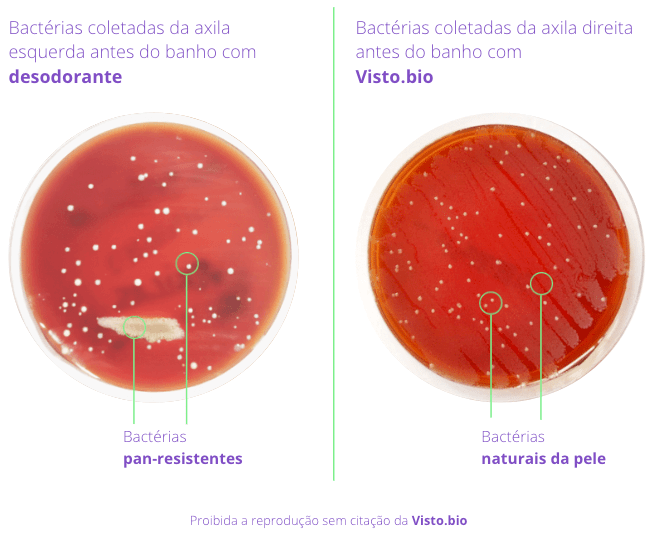 bacteria na pele da axila